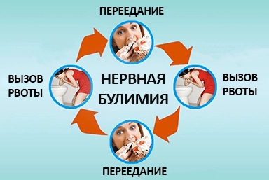 Лечение булимии в Кабардинке